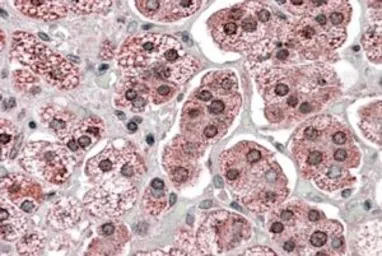 Anti-KPNA6 antibody, Internal used in IHC (Paraffin sections) (IHC-P). GTX88712