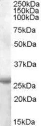 Anti-APOBEC2 (aa180 - 190) antibody, Internal used in Western Blot (WB). GTX88719