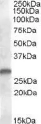 Anti-CLEC1B antibody, Internal used in Western Blot (WB). GTX88720