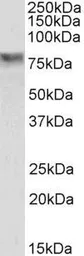 Anti-SEL1L antibody, Internal used in Western Blot (WB). GTX88726