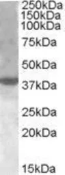 Anti-XBP1 antibody, Internal used in Western Blot (WB). GTX88727
