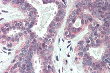Anti-XBP1 antibody, Internal used in IHC (Paraffin sections) (IHC-P). GTX88727
