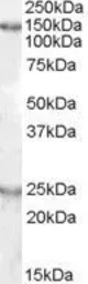 Anti-mKIAA0319 antibody, Internal used in Western Blot (WB). GTX88729