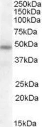 Anti-SERPINA12 antibody, Internal used in Western Blot (WB). GTX88737