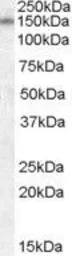 Anti-SAP97 antibody, Internal used in Western Blot (WB). GTX88739