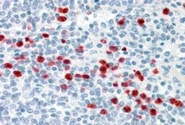 Anti-GCC2 antibody, Internal used in IHC (Paraffin sections) (IHC-P). GTX88740