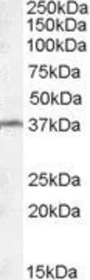 Anti-TSGA2 antibody, Internal used in Western Blot (WB). GTX88743