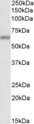 Anti-ATG16L1 antibody, Internal used in Western Blot (WB). GTX88747