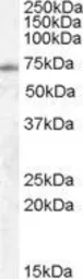 Anti-EXOC7 antibody, Internal used in Western Blot (WB). GTX88750