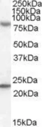 Anti-DHX58 antibody, C-term used in Western Blot (WB). GTX88752