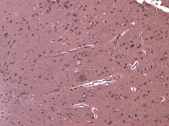 Anti-DHX58 antibody, C-term used in IHC (Paraffin sections) (IHC-P). GTX88752