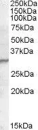 Anti-PGRPS antibody, C-term used in Western Blot (WB). GTX88753