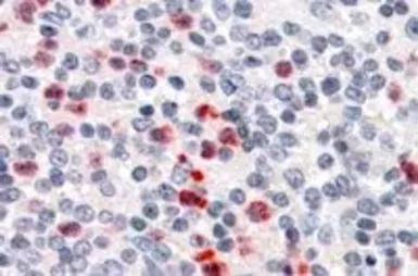 Anti-PGRPS antibody, C-term used in IHC (Paraffin sections) (IHC-P). GTX88753