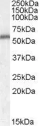 Anti-Neurotrophin 4 antibody, Internal used in Western Blot (WB). GTX88754