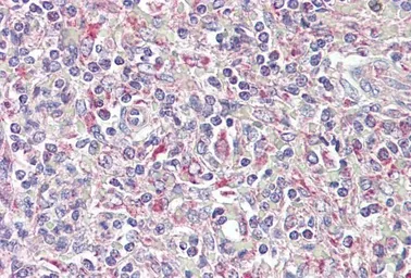Anti-TRIB1 antibody, C-term used in IHC (Paraffin sections) (IHC-P). GTX88755