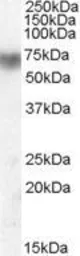 Anti-Lactoperoxidase antibody, Internal used in Western Blot (WB). GTX88759