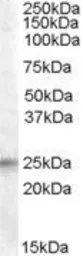Anti-IGFBP6 antibody, Internal used in Western Blot (WB). GTX88766