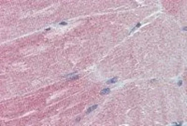 Anti-IGFBP6 antibody, Internal used in IHC (Paraffin sections) (IHC-P). GTX88766
