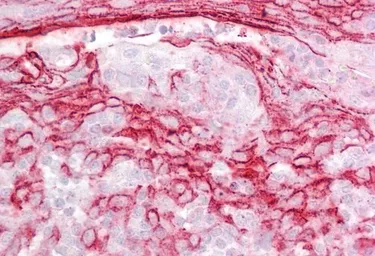 Anti-IGFBP7 antibody, Internal used in IHC (Paraffin sections) (IHC-P). GTX88767