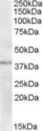 Anti-TXNDC6 antibody, C-term used in Western Blot (WB). GTX88768