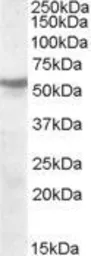Anti-AChR beta 1 antibody, Internal used in Western Blot (WB). GTX88771