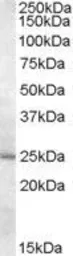 Anti-MTHFS antibody, Internal used in Western Blot (WB). GTX88772