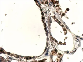 Anti-DUOX1 antibody, Internal used in IHC (Paraffin sections) (IHC-P). GTX88773