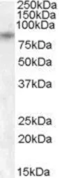 Anti-TRPV5 antibody, Internal used in Western Blot (WB). GTX88774