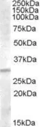 Anti-IGFBP4 antibody, C-term used in Western Blot (WB). GTX88775