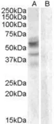 Anti-Arylsulfatase D antibody, Internal used in Western Blot (WB). GTX88781