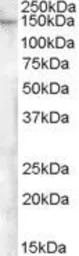 Anti-FAM62A antibody, Internal used in Western Blot (WB). GTX88786