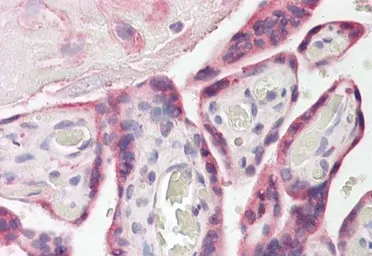 Anti-FAM62A antibody, Internal used in IHC (Paraffin sections) (IHC-P). GTX88786