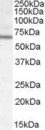 Anti-DACH2 antibody, Internal used in Western Blot (WB). GTX88789