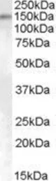 Anti-SENP6 antibody, Internal used in Western Blot (WB). GTX88791