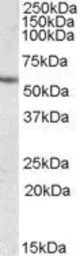 Anti-CES1 antibody, Internal used in Western Blot (WB). GTX88792