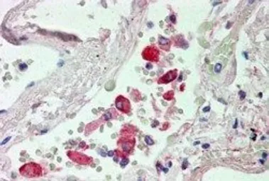 Anti-CES1 antibody, Internal used in IHC (Paraffin sections) (IHC-P). GTX88792