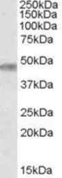 Anti-TOM1L1 antibody, Internal used in Western Blot (WB). GTX88806
