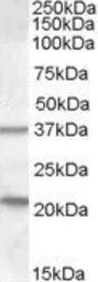 Anti-TUSC3 antibody, Internal used in Western Blot (WB). GTX88807