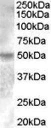 Anti-ERR gamma antibody, Internal used in Western Blot (WB). GTX88809