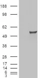 Anti-ERR gamma antibody, Internal used in Western Blot (WB). GTX88809