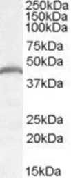 Anti-PNPLA3 antibody, Internal used in Western Blot (WB). GTX88810