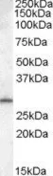 Anti-MTHFD2L antibody, N-term used in Western Blot (WB). GTX88812