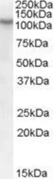 Anti-BOC antibody, Internal used in Western Blot (WB). GTX88814