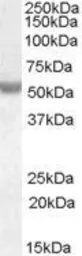 Anti-NOVA1 antibody, Internal used in Western Blot (WB). GTX88815
