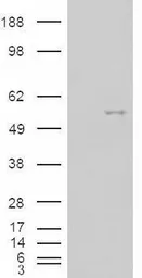 Anti-NOVA1 antibody, Internal used in Western Blot (WB). GTX88815