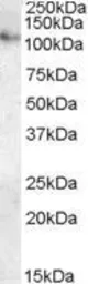 Anti-ATP13A1 antibody, Internal used in Western Blot (WB). GTX88817