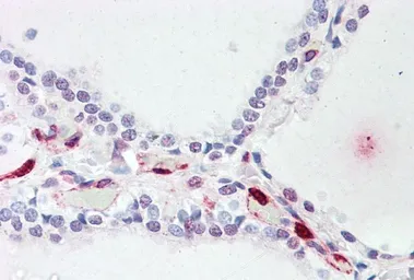 Anti-ATP13A1 antibody, Internal used in IHC (Paraffin sections) (IHC-P). GTX88817