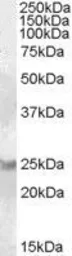 Anti-RAB8A antibody, C-term used in Western Blot (WB). GTX88822