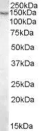 Anti-Pyruvate Carboxylase antibody, Internal used in Western Blot (WB). GTX88823