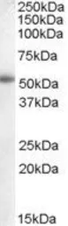 Anti-Aromatase antibody, Internal used in Western Blot (WB). GTX88826